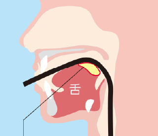 口からの胃内視鏡