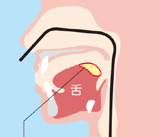 鼻からの胃内視鏡